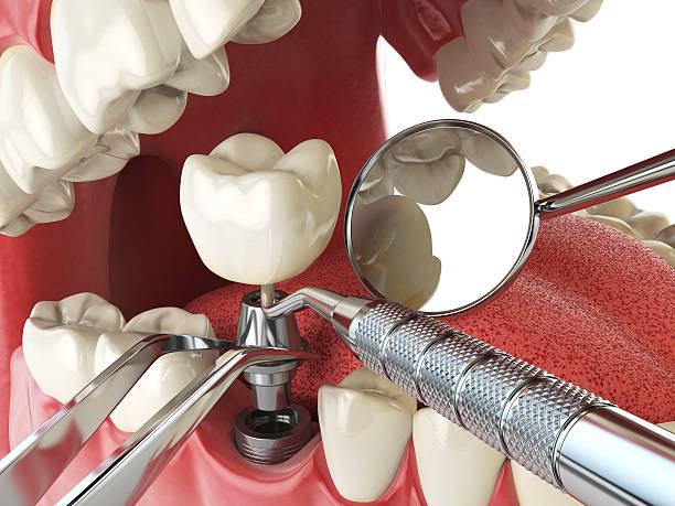 Best Urgent Care for Lost Fillings or Crowns in Mount Ora, OH